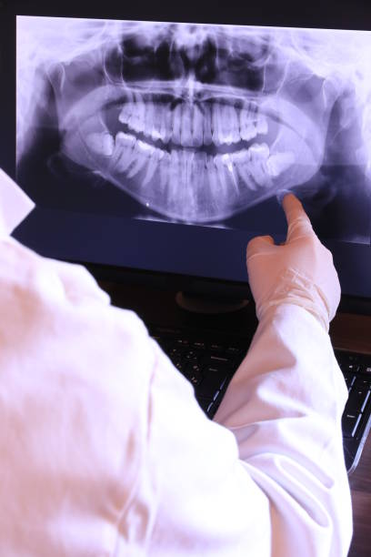 Best Emergency Root Canal Treatment in Schaumburg, IL