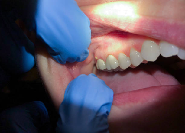 Best Orthodontic Emergency Dentist in Schaumburg, IL