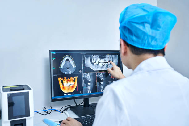 Best Emergency Dental Extractions in Schaumburg, IL