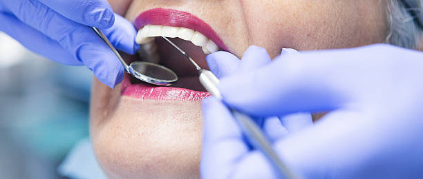 Best Emergency Root Canal Treatment in Schaumburg, IL